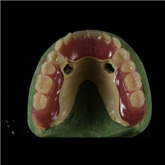 Peek Framework ฟันปลอม