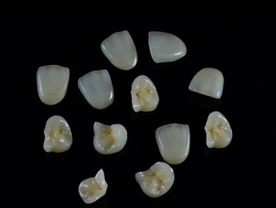 วิธีเลือกกาวติดฟันที่ดีที่สุดสำหรับครอบฟัน: คำแนะนำล่าสุด