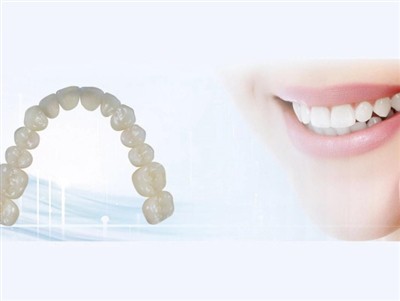 การจ้างบุคคลภายนอกจากห้องปฏิบัติการทันตกรรม: ข้อดี ข้อเสีย และข้อควรพิจารณาที...