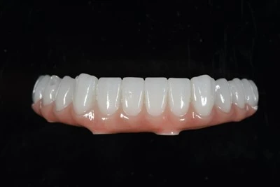 ขากรรไกรล่างทั้งหมด-บน-สะพาน X Zirconia